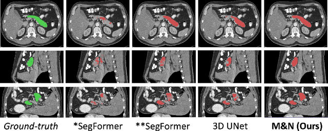 Figure 2 for Semi-Supervised 3D Medical Segmentation from 2D Natural Images Pretrained Model