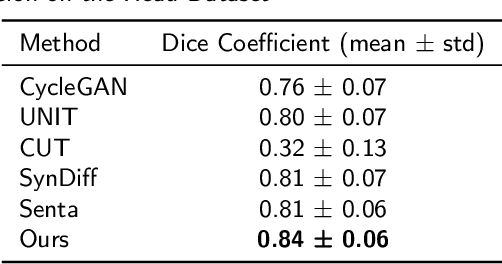 Figure 3 for Path and Bone-Contour Regularized Unpaired MRI-to-CT Translation