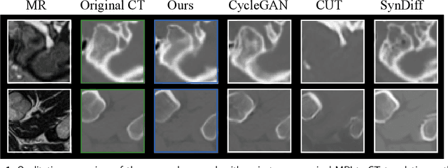 Figure 1 for Path and Bone-Contour Regularized Unpaired MRI-to-CT Translation
