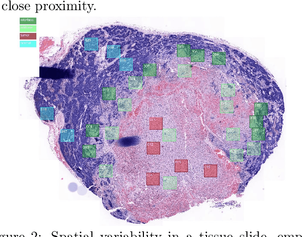 Figure 2 for Spatially-Delineated Domain-Adapted AI Classification: An Application for Oncology Data