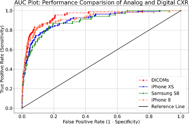 Figure 3 for Comparative Evaluation of Digital and Analog Chest Radiographs to Identify Tuberculosis using Deep Learning Model