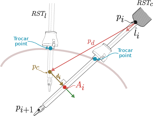 Figure 4 for A hierarchical framework for collision avoidance in robot-assisted minimally invasive surgery