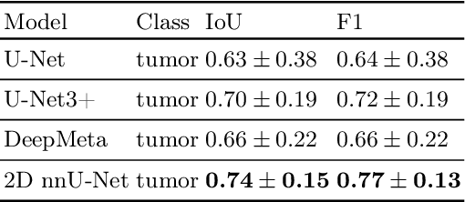 Figure 4 for Lung tumor segmentation in MRI mice scans using 3D nnU-Net with minimum annotations