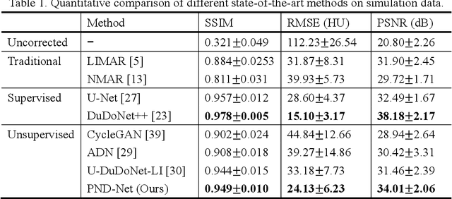 Figure 2 for PND-Net: Physics based Non-local Dual-domain Network for Metal Artifact Reduction