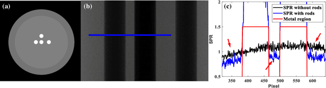 Figure 1 for PND-Net: Physics based Non-local Dual-domain Network for Metal Artifact Reduction