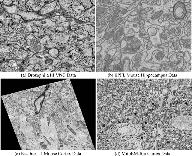 Figure 1 for Weakly-Supervised Cross-Domain Segmentation of Electron Microscopy with Sparse Point Annotation