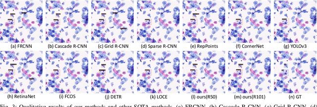 Figure 3 for Holistic and Historical Instance Comparison for Cervical Cell Detection