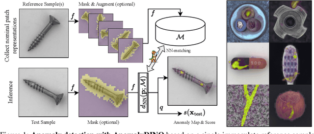 Figure 1 for AnomalyDINO: Boosting Patch-based Few-shot Anomaly Detection with DINOv2