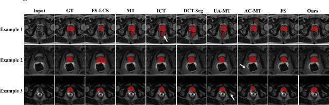 Figure 4 for Collaborative Learning for Annotation-Efficient Volumetric MR Image Segmentation