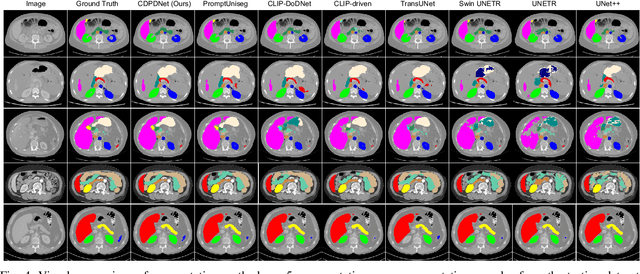 Figure 4 for CDPDNet: Integrating Text Guidance with Hybrid Vision Encoders for Medical Image Segmentation