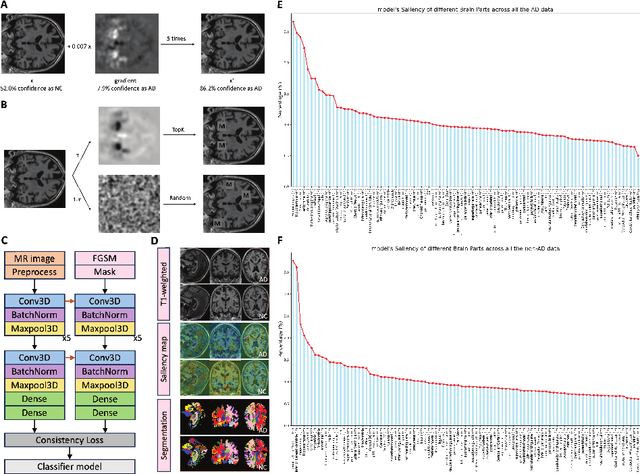 Figure 1 for Quantitative Evaluation of the Saliency Map for Alzheimer's Disease Classifier with Anatomical Segmentation