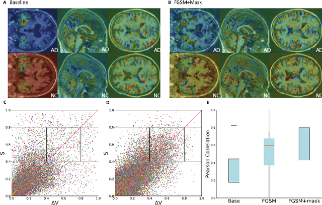 Figure 3 for Quantitative Evaluation of the Saliency Map for Alzheimer's Disease Classifier with Anatomical Segmentation