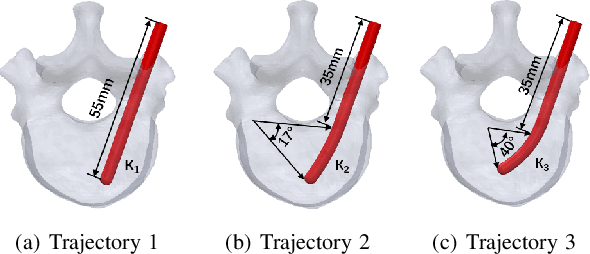 Figure 2 for Towards Biomechanics-Aware Design of a Steerable Drilling Robot for Spinal Fixation Procedures with Flexible Pedicle Screws