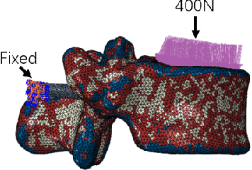 Figure 3 for Towards Biomechanics-Aware Design of a Steerable Drilling Robot for Spinal Fixation Procedures with Flexible Pedicle Screws