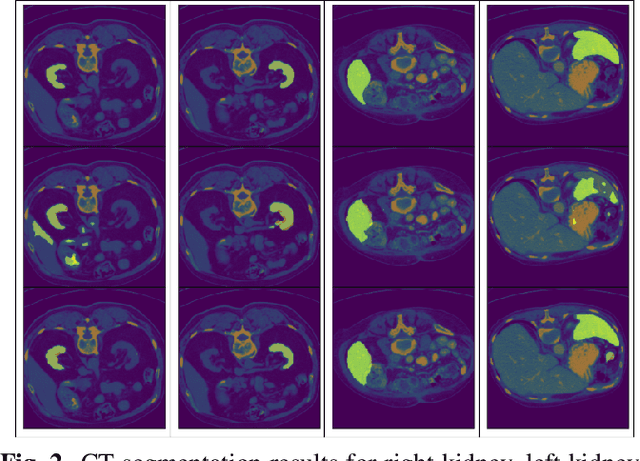 Figure 3 for DINOv2 based Self Supervised Learning For Few Shot Medical Image Segmentation