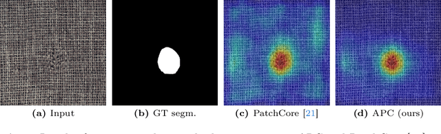 Figure 1 for AnomalousPatchCore: Exploring the Use of Anomalous Samples in Industrial Anomaly Detection