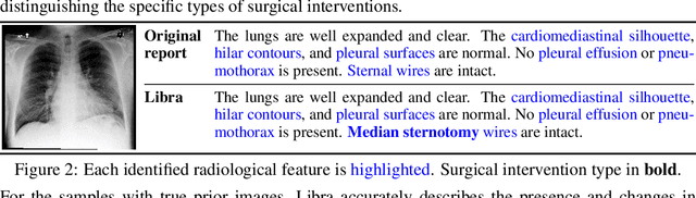 Figure 4 for Libra: Leveraging Temporal Images for Biomedical Radiology Analysis