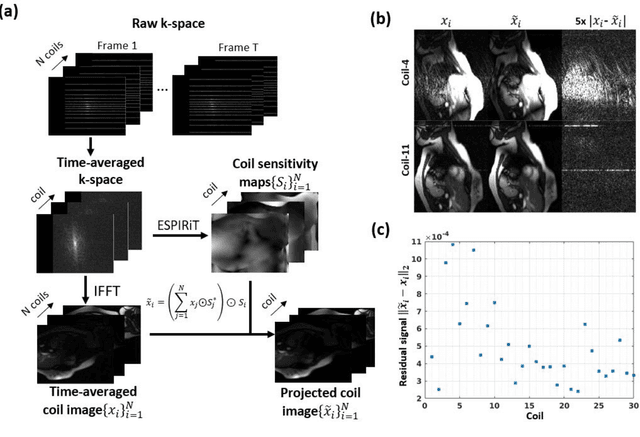 Figure 1 for Coil Reweighting to Suppress Motion Artifacts in Real-Time Exercise Cine Imaging