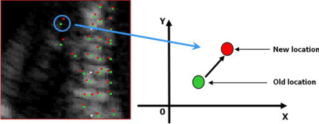 Figure 1 for A Deep Learning Based Method for Fast Registration of Cardiac Magnetic Resonance Images