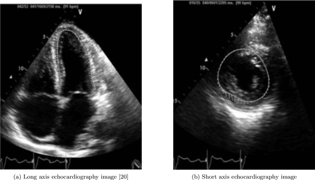 Figure 3 for A Deep Learning Based Method for Fast Registration of Cardiac Magnetic Resonance Images