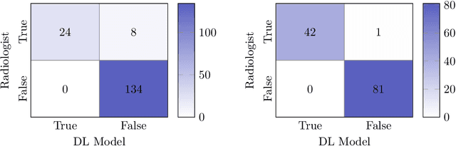 Figure 4 for Deep Learning Segmentation of Ascites on Abdominal CT Scans for Automatic Volume Quantification