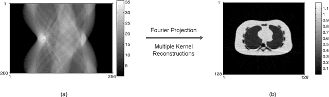Figure 4 for 3D Medical Imaging Segmentation on Non-Contrast CT