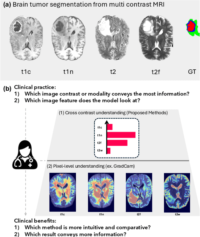 Figure 1 for Here Comes the Explanation: A Shapley Perspective on Multi-contrast Medical Image Segmentation