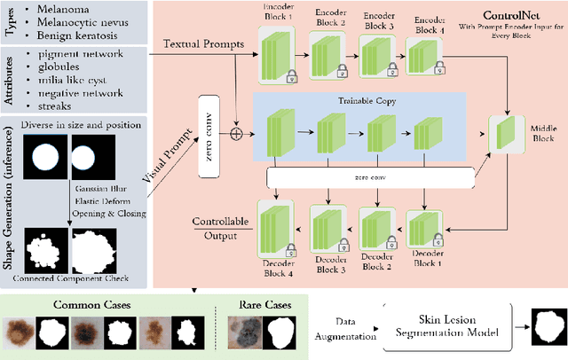 Figure 3 for Boosting Dermatoscopic Lesion Segmentation via Diffusion Models with Visual and Textual Prompts