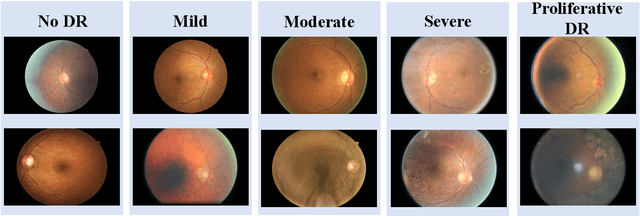 Figure 4 for Analysis of the Two-Step Heterogeneous Transfer Learning for Laryngeal Blood Vessel Classification: Issue and Improvement