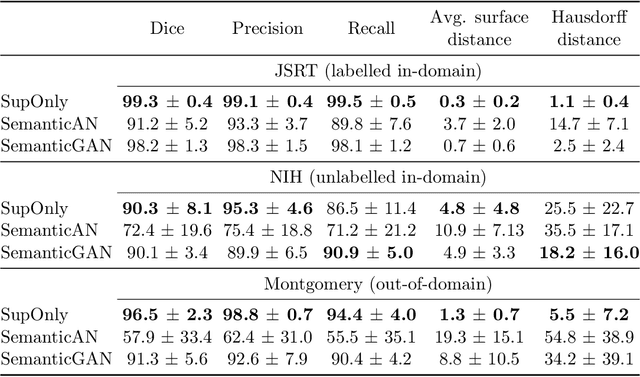 Figure 1 for Analysing the effectiveness of a generative model for semi-supervised medical image segmentation