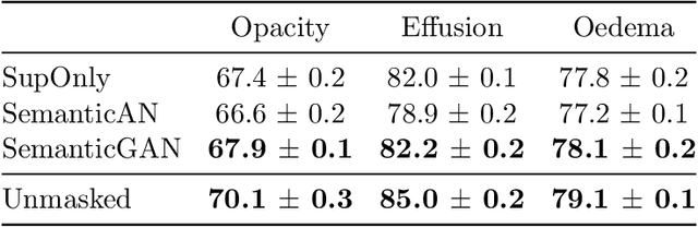 Figure 3 for Analysing the effectiveness of a generative model for semi-supervised medical image segmentation