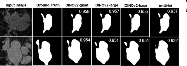 Figure 2 for Multi-Scale Feature Fusion with Image-Driven Spatial Integration for Left Atrium Segmentation from Cardiac MRI Images