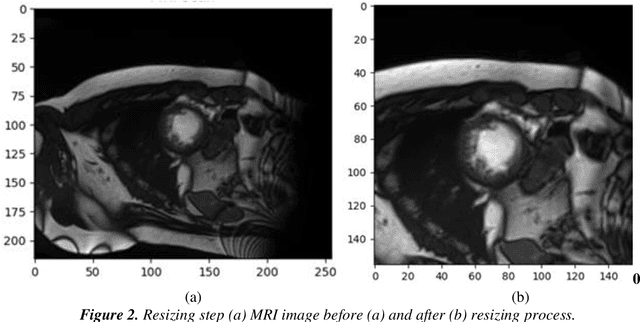 Figure 3 for An Improved Approach for Cardiac MRI Segmentation based on 3D UNet Combined with Papillary Muscle Exclusion