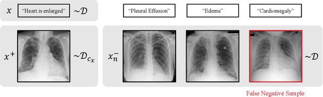 Figure 1 for Sample-Specific Debiasing for Better Image-Text Models