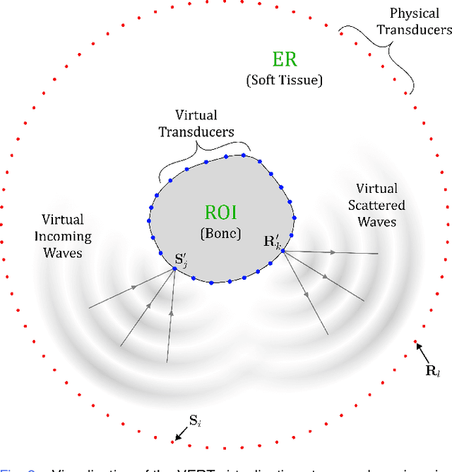 Figure 2 for Virtual Extended-Range Tomography (VERT): Contact-free realistic ultrasonic bone imaging