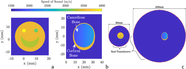 Figure 4 for Virtual Extended-Range Tomography (VERT): Contact-free realistic ultrasonic bone imaging