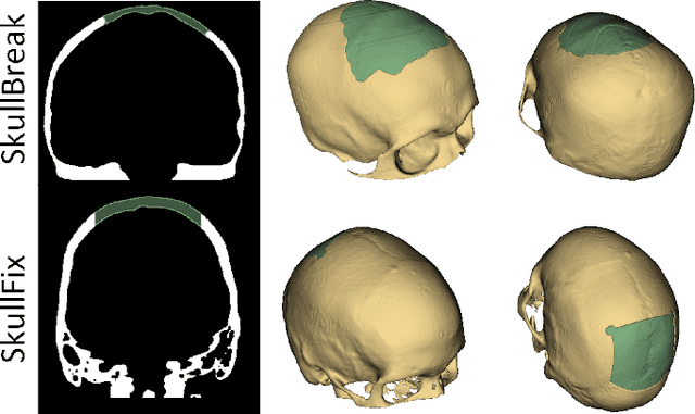 Figure 2 for Automatic Cranial Defect Reconstruction with Self-Supervised Deep Deformable Masked Autoencoders