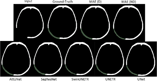 Figure 3 for Automatic Cranial Defect Reconstruction with Self-Supervised Deep Deformable Masked Autoencoders