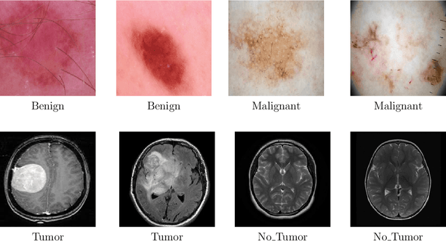 Figure 1 for DeepMediX: A Deep Learning-Driven Resource-Efficient Medical Diagnosis Across the Spectrum