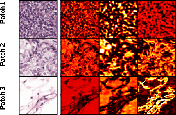 Figure 4 for ContriMix: Unsupervised disentanglement of content and attribute for domain generalization in microscopy image analysis