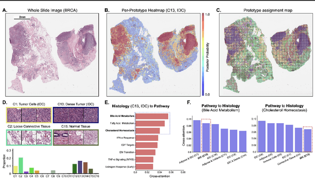 Figure 4 for Multimodal Prototyping for cancer survival prediction