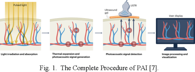 Figure 1 for Advances in Photoacoustic Imaging Reconstruction and Quantitative Analysis for Biomedical Applications