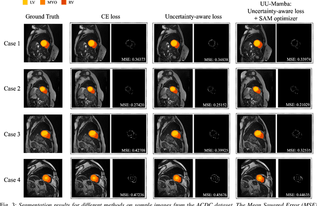 Figure 3 for UU-Mamba: Uncertainty-aware U-Mamba for Cardiac Image Segmentation