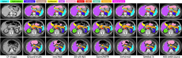 Figure 3 for MA-SAM: Modality-agnostic SAM Adaptation for 3D Medical Image Segmentation