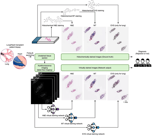 Figure 1 for Label-free evaluation of lung and heart transplant biopsies using virtual staining