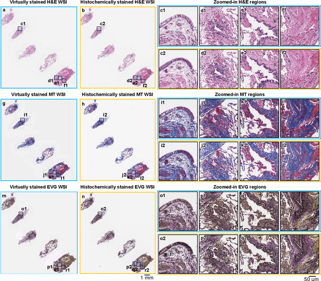 Figure 2 for Label-free evaluation of lung and heart transplant biopsies using virtual staining