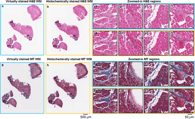 Figure 3 for Label-free evaluation of lung and heart transplant biopsies using virtual staining