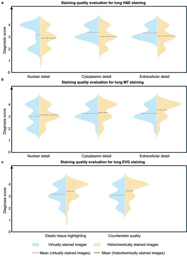 Figure 4 for Label-free evaluation of lung and heart transplant biopsies using virtual staining