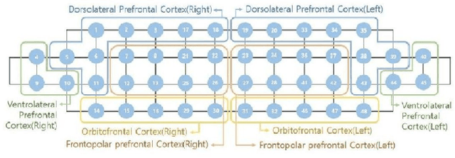 Figure 4 for A Pilot Study on the Comparison of Prefrontal Cortex Activities of Robotic Therapies on Elderly with Mild Cognitive Impairment