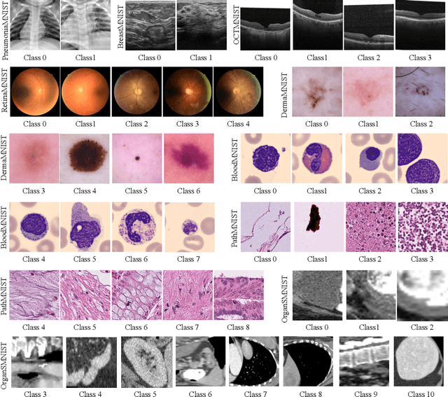 Figure 3 for Benchmarking MedMNIST dataset on real quantum hardware